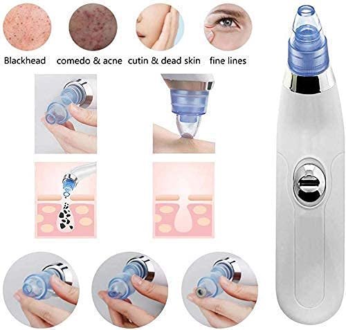 Derma suction Blackhead Remover Vacuum Acne remover| beauty Tool Black Spot Pore Cleaner askddeal.com